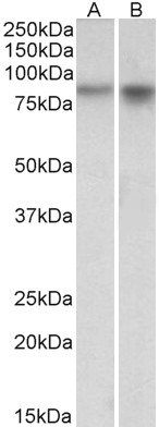 AF3412a (1 µg/ml) staining of Mouse (A) and Rat (B) Brain lysates (35 µg protein in RIPA buffer). Primary incubation was 1 hour. Detected by chemiluminescence.