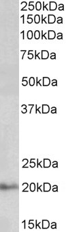 AF3366a (0.03 µg/ml) staining of Human Kidney lysate (35 µg protein in RIPA buffer). Primary incubation was 1 hour. Detected by chemiluminescence.