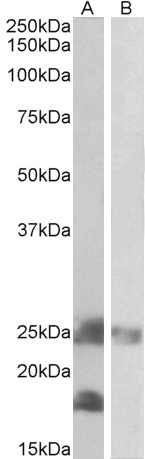 AF3366a (0.2 µg/ml) staining of Mouse (A) and Rat (B) Skeletal Muscle lysates (35 µg protein in RIPA buffer). Primary incubation was 1 hour. Detected by chemiluminescence.