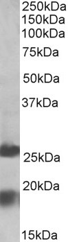 AF3357a (2 µg/ml) staining of Human Frontal Cortex lysate (35 µg protein in RIPA buffer). Primary incubation was 1 hour. Detected by chemiluminescence.