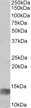 AF3928a (1 µg/ml) staining of Human Glioma lysate (35 µg protein in RIPA buffer). Primary incubation was 1 hour. Detected by chemiluminescence.