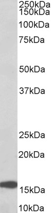 AF3896a (0.1 µg/ml) staining of Human Colorectal Cancer lysate (35 µg protein in RIPA buffer). Primary incubation was 1 hour. Detected by chemiluminescence.
