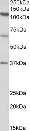 AF3694a (1 µg/ml) staining of Human Testis lysate (35 µg protein in RIPA buffer). Primary incubation was 1 hour. Detected by chemiluminescence.