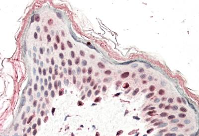 AF3617a (5 µg/ml) staining of paraffin embedded Human Skin. Steamed antigen retrieval with citrate buffer pH 6, AP-staining.