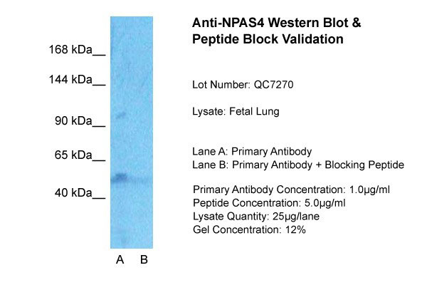 NPAS4 antibody - middle region (AI10066) in Fetal Lung cells using Western BlotHost: RabbitTarget Name:NPAS4Sample Tissue:Fetal Lung Lane A:Primary Antibody Lane B:Primary Antibody + Blocking Peptide Primary Antibody Concentration:1ug/mlPeptide Concentration: 5ug/mlLysate Quantity: 25ug/lane/LaneGel Concentration: 0.12