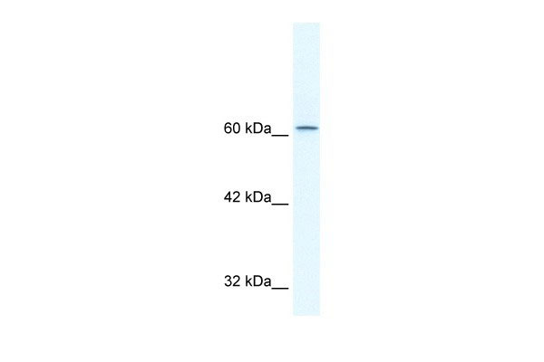 TLE3 antibody - N-terminal region (AI10053) in Human HepG2 cells using Western BlotWB Suggested Anti-TLE3 Antibody Titration: 2.5ug/ml Positive Control: HepG2 cell lysate