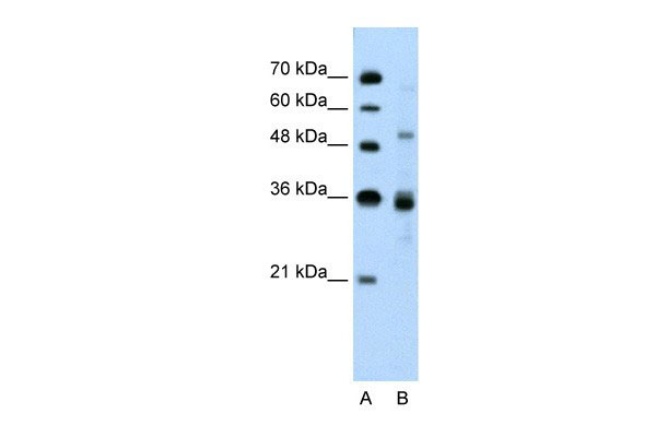 TNRC4 antibody - N-terminal region (AI10022) in Human Jurkat cells using Western BlotWB Suggested Anti-TNRC4 Antibody Titration: 0.2-1 ug/ml ELISA Titer: 1:1562500 Positive Control: Jurkat cell lysate