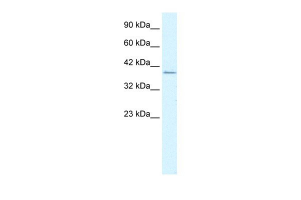 RIMS3 antibody - C-terminal region (AI10145) in Human Jurkat cells using Western BlotWB Suggested Anti-RIMS3 Antibody Titration: 1.25ug/ml ELISA Titer: 1:312500 Positive Control: Jurkat cell lysateRIMS3 is strongly supported by BioGPS gene expression data to be expressed in Human Jurkat cells