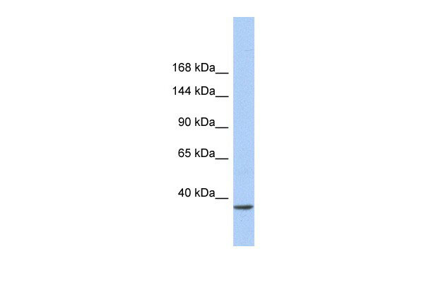 SMARCAD1 antibody - N-terminal region (AI10135) in Human Heart cells using Western BlotWB Suggested Anti-SMARCAD1 Antibody Titration: 0.2-1 ug/ml ELISA Titer: 1:12500 Positive Control: Human heart