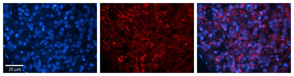 Rabbit Anti-ZFR Antibody (AI10134) ) in Human Pineal Tissue using ImmunohistochemistryRabbit Anti-ZFR Antibody Catalog Number: AI10134 Formalin Fixed Paraffin Embedded Tissue: Human Pineal Tissue Observed Staining: Cytoplasmic and nuclear in pinelocytes & intersticial cells Primary Antibody Concentration: 1:100 Other Working Concentrations: 1/600 Secondary Antibody: Donkey anti-Rabbit-Cy3 Secondary Antibody Concentration: 1:200 Magnification: 20X Exposure Time: 0.5 - 2.0 sec 