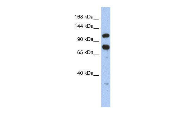 ZFR antibody - middle region (AI10134) in Human HT1080 cells using Western BlotWB Suggested Anti-ZFR Antibody Titration: 0.2-1 ug/ml ELISA Titer: 1:62500 Positive Control: HT1080 cell lysateZFR is strongly supported by BioGPS gene expression data to be expressed in Human HT1080 cells