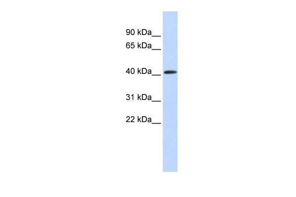PARP11 antibody - middle region (AI10105) in Human Muscle cells using Western BlotWB Suggested Anti-PARP11 Antibody Titration: 0.2-1 ug/ml ELISA Titer: 1:312500 Positive Control: Human Muscle
