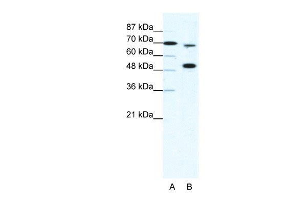 MLL4 antibody - N-terminal region (AI10100) in Human HepG2 cells using Western BlotWB Suggested Anti-MLL4 Antibody Titration: 5ug/ml Positive Control: HepG2 cell lysateKMT2B is strongly supported by BioGPS gene expression data to be expressed in Human HepG2 cells