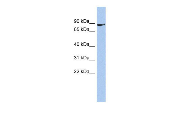 ZNF189 antibody - middle region (AI10095) in Human OVCAR-3 cells using Western BlotWB Suggested Anti-ZNF189 Antibody Titration: 0.2-1 ug/ml ELISA Titer: 1:62500 Positive Control: OVCAR-3 cell lysateZNF189 is supported by BioGPS gene expression data to be expressed in OVCAR3