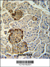REG3G Antibody (Center) (Cat. #AP5606c) immunohistochemistry analysis in formalin fixed and paraffin embedded human pancreas tissue followed by peroxidase conjugation of the secondary antibody and DAB staining. This data demonstrates the use of the REG3G Antibody (Center) for immunohistochemistry. Clinical relevance has not been evaluated.