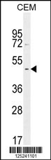 GDPD5 Antibody (center) (Cat. #AP10992c) western blot analysis in CEM cell line lysates (35ug/lane).This demonstrates the GDPD5 antibody detected the GDPD5 protein (arrow).