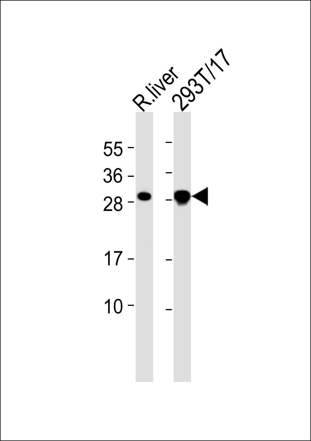 All lanes : Anti-Cerebellin 4 Antibody at 1:1000 dilution Lane 1: rat liver lysates Lane 2: 293T/17 whole cell lysates Lysates/proteins at 20 µg per lane. Secondary Goat Anti-Rabbit IgG, (H+L),Peroxidase conjugated at 1/10000 dilution Predicted band size : 22 kDa Blocking/Dilution buffer: 5% NFDM/TBST.