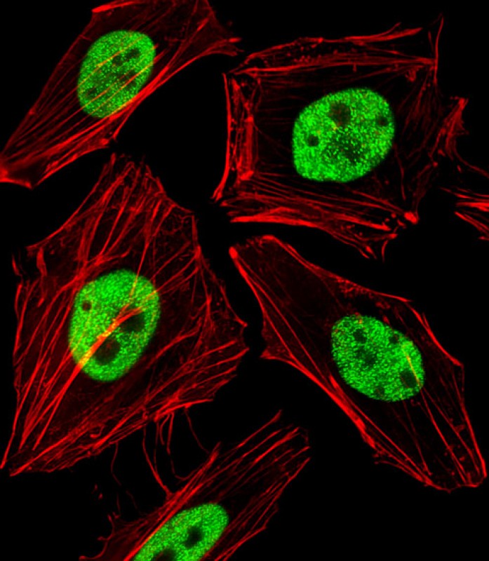 Fluorescent image of Hela cells stained with WDR82 Antibody (N-term)(Cat#AP20978b). AP20978b was diluted at 1:25 dilution. An Alexa Fluor 488-conjugated goat anti-rabbit lgG at 1:400 dilution was used as the secondary antibody (green). Cytoplasmic actin was counterstained with Alexa Fluor® 555 conjugated with Phalloidin (red).
