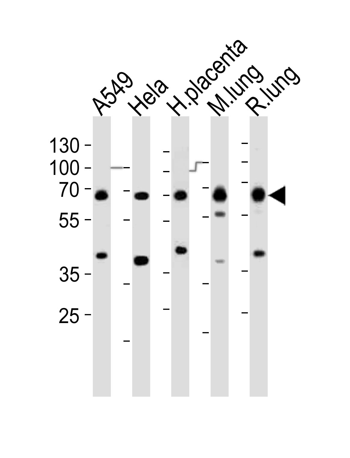 Western blot analysis of lysates from A549, Hela cell line, human placenta, mouse lung, rat lung tissue (from left to right), using EHD2 Antibody (C-term)(Cat. #AP21050a). AP21050a was diluted at 1:1000 at each lane. A goat anti-rabbit IgG H&L(HRP) at 1:10000 dilution was used as the secondary antibody. Lysates at 20ug per lane.