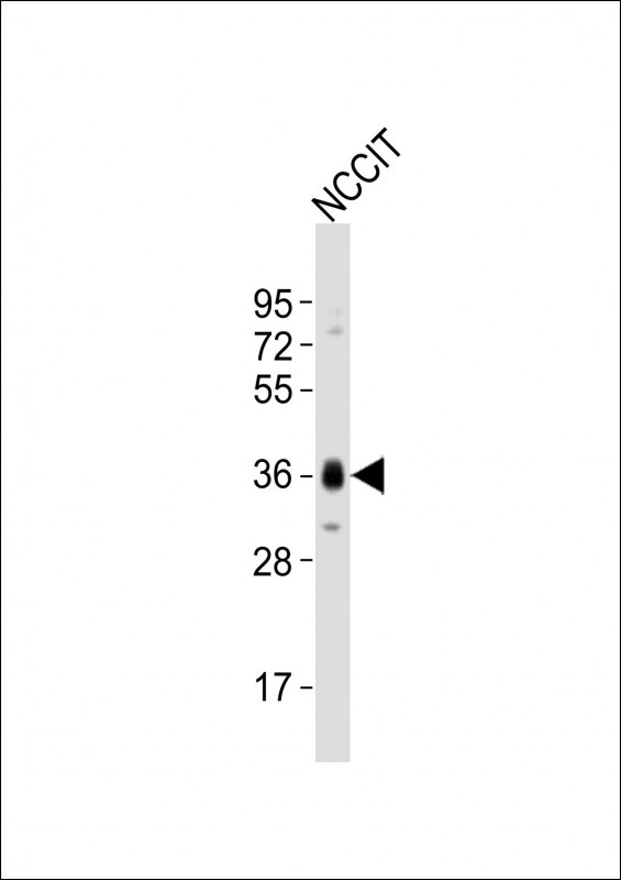 Anti-(Mouse) Sox2 Antibody (N-term) at 1:1000 dilution + NCCIT whole cell lysates Lysates/proteins at 20 µg per lane. Secondary Goat Anti-Rabbit IgG, (H+L), Peroxidase conjugated at 1/10000 dilution Predicted band size :34 kDa Blocking/Dilution buffer: 5% NFDM/TBST.