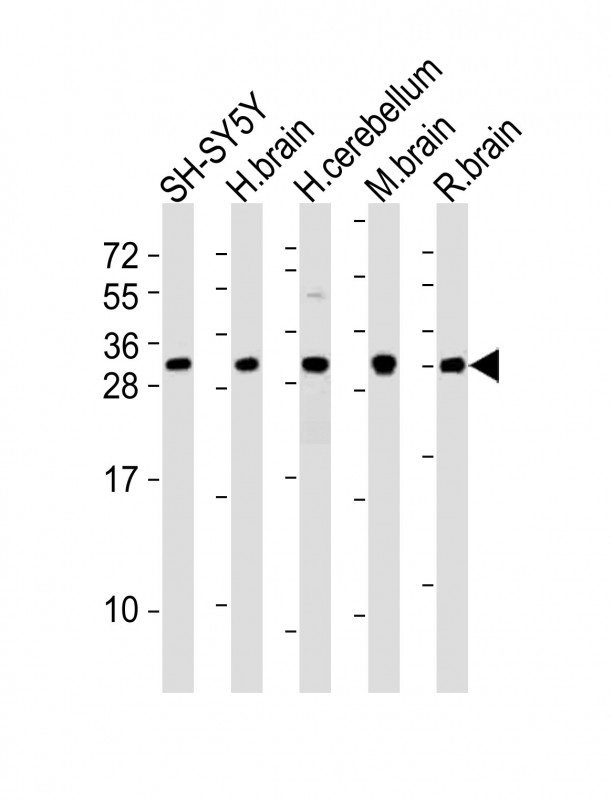 All lanes : Anti-FGF14 Antibody (C-term) at 1:2000 dilution Lane 1: SH-SY5Y whole cell lysates Lane 2: human brain lysates Lane 3: human cerebellum lysates Lane 4: mouse brain lysates Lane 5: rat brain lysates Lysates/proteins at 20 µg per lane. Secondary Goat Anti-Rabbit IgG, (H+L), Peroxidase conjugated at 1/10000 dilution Predicted band size : 28 kDa Blocking/Dilution buffer: 5% NFDM/TBST.