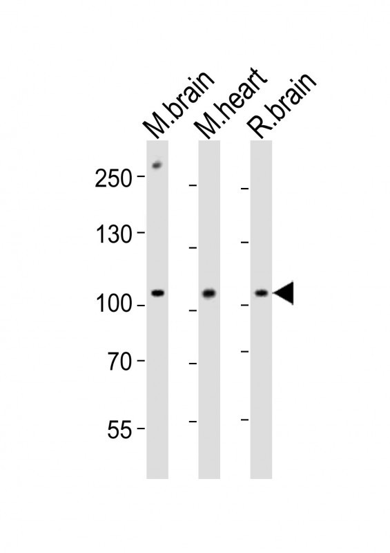 All lanes : Anti-Ephb1 Antibody (Center) at 1:1000 dilution Lane 1: mouse brain lysates Lane 2: mouse heart lysates Lane 3: rat brain lysates Lysates/proteins at 20 µg per lane. Secondary Goat Anti-Rabbit IgG, (H+L), Peroxidase conjugated at 1/10000 dilution Predicted band size : 110 kDa Blocking/Dilution buffer: 5% NFDM/TBST.