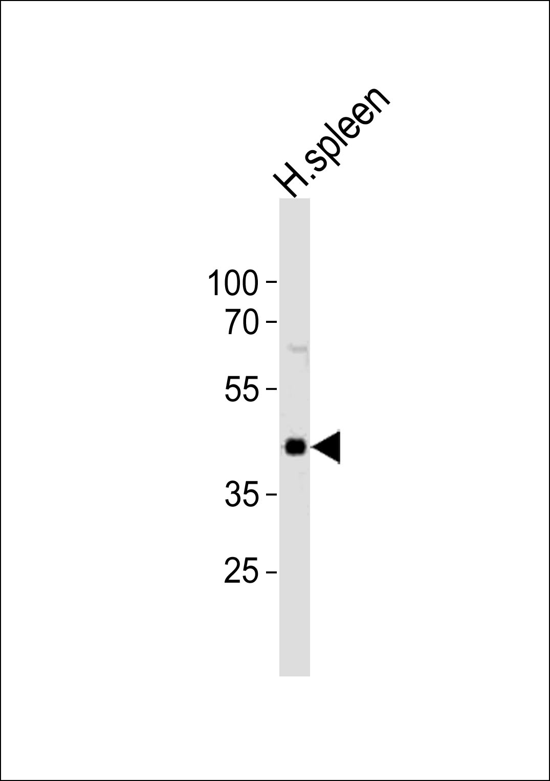 Western blot analysis of lysate from human spleen tissue lysate, using CHST12 Antibody (N-term)(Cat. #AP21028b). AP21028b was diluted at 1:1000. A goat anti-rabbit IgG H&L(HRP) at 1:10000 dilution was used as the secondary antibody. Lysate at 20ug.