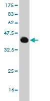 Antibody Reactive Against Recombinant Protein.Western Blot detection against Immunogen (36.63 KDa) . 