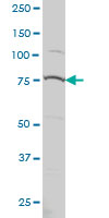 PRPF3 monoclonal antibody (M01), clone 3H6 Western Blot analysis of PRPF3 expression in Hela S3 NE ( (Cat # AT3442a )