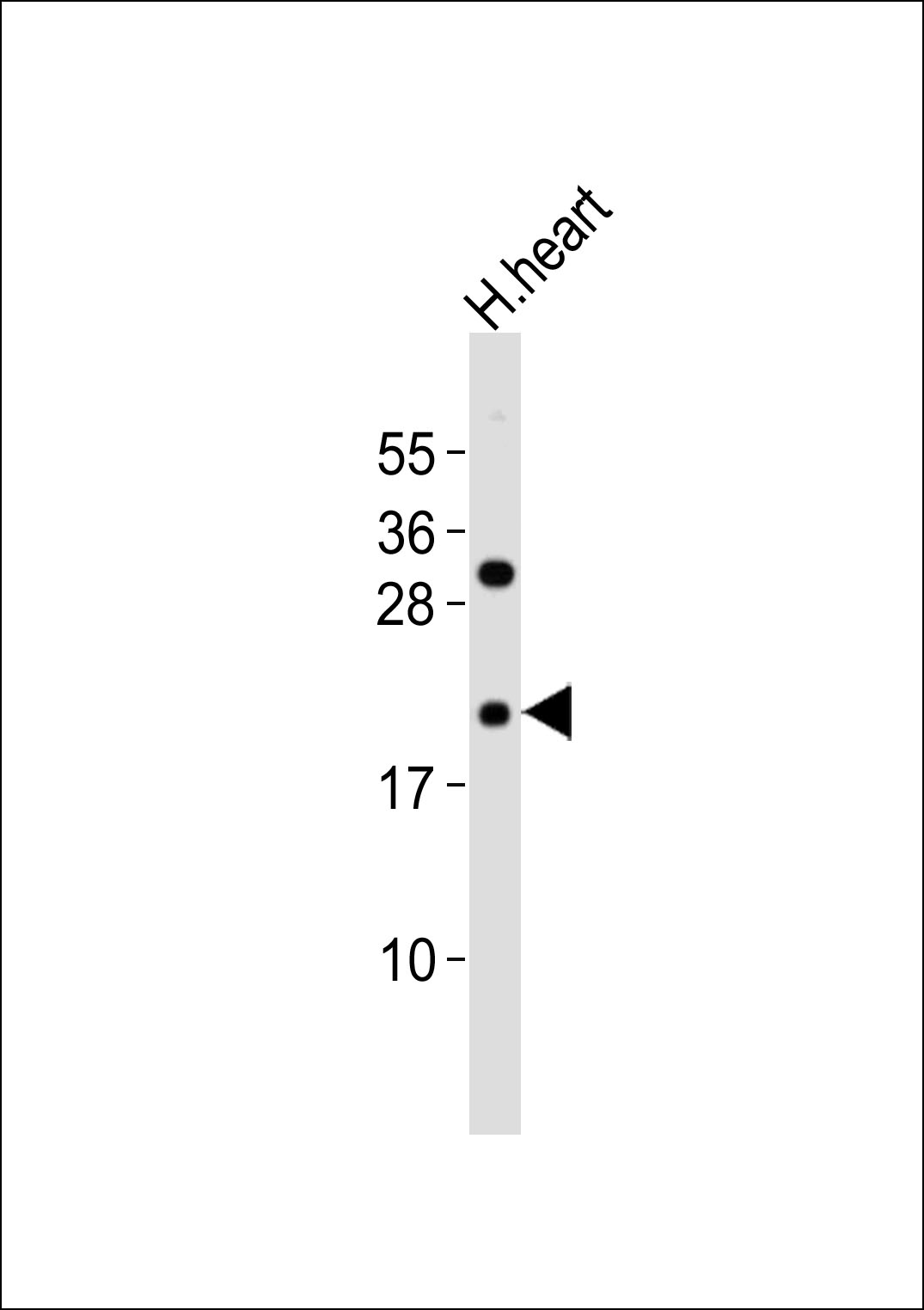 Anti-RhoD Antibodyat 1:1000 dilution + H.heart tissue lysates Lysates/proteins at 20 µg per lane. Secondary Goat Anti-Rabbit IgG, (H+L),Peroxidase conjugated at 1/10000 dilution Predicted band size : 23 kDa Blocking/Dilution buffer: 5% NFDM/TBST.