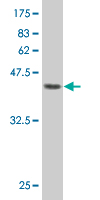 Antibody Reactive Against Recombinant Protein.Western Blot detection against Immunogen (45.98 KDa) . 