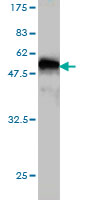 Antibody Reactive Against Recombinant Protein.Western Blot detection against Immunogen (45.98 KDa) . 