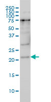 PRKRIP1 monoclonal antibody (M05), clone 4D11-3F11 Western Blot analysis of PRKRIP1 expression in Hela S3 NE ( (Cat # AT3435a )