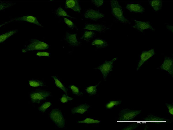 Immunofluorescence of monoclonal antibody to PRKRIP1 on HeLa cell . [antibody concentration 10 ug/ml]