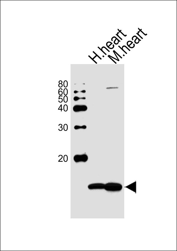 Western blot analysis of lysates from human heart and mouse heart tissue lysate (from left to right), using NDUFV3 Antibody (C-term)(Cat. #AW5012). AW5012 was diluted at 1:1000 at each lane. A goat anti-rabbit IgG H&L(HRP) at 1:10000 dilution was used as the secondary antibody.