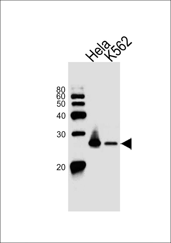 Western blot analysis of lysates from Hela, K562 cell line (from left to right), using MAD2L2 Antibody (C-term)(Cat. #AW5027). AW5027 was diluted at 1:1000 at each lane. A goat anti-rabbit IgG H&L(HRP) at 1:10000 dilution was used as the secondary antibody.