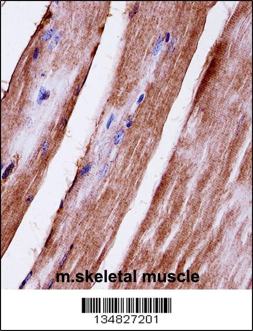 Mouse Mapk3 Antibody (C-term) (AW5034)immunohistochemistry analysis in formalin fixed and paraffin embedded mouse skeletal muscle followed by peroxidase conjugation of the secondary antibody and DAB staining.This data demonstrates the use of Mouse Mapk3 Antibody (C-term) for immunohistochemistry. Clinical relevance has not been evaluated.