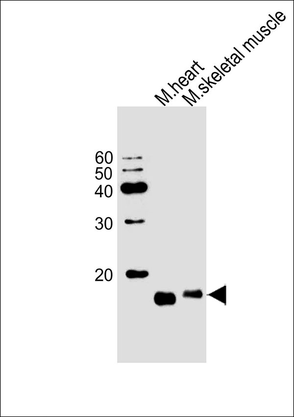 Western blot analysis of lysates from mouse heart,mouse skeletal muscle cell line (from left to right), using PLM Antibody (E1)(Cat. #AW5084). AW5084 was diluted at 1:1000 at each lane. A goat anti-rabbit IgG H&L(HRP) at 1:10000 dilution was used as the secondary antibody.Lysates at 20ug per lane.