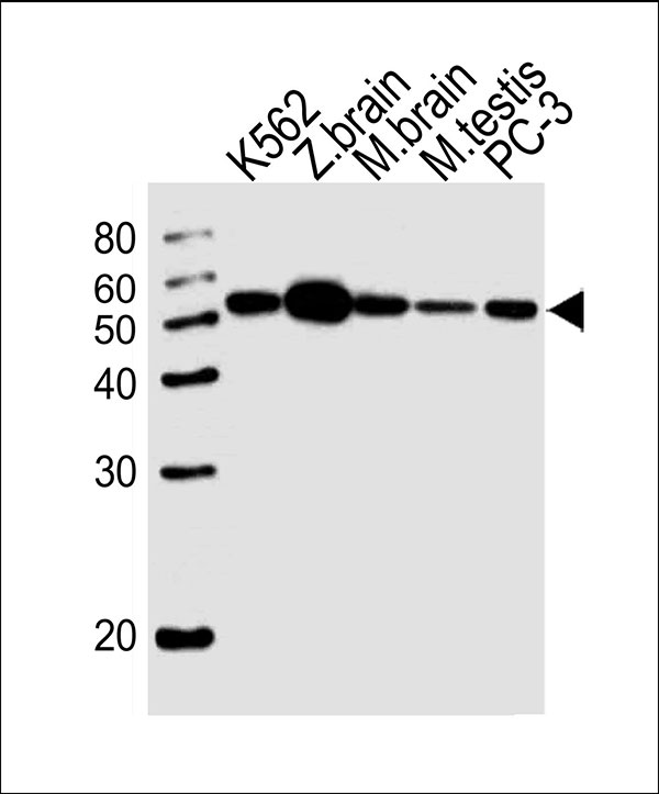 Western blot analysis of lysates from K562 cell line,zebra fish brain,mouse brain,mouse testis tissue lysate,PC-3 cell line (from left to right), using DMRTA2 Antibody (C-term)(Cat. #AW5104). AW5104 was diluted at 1:1000 at each lane. A goat anti-rabbit IgG H&L(HRP) at 1:10000 dilution was used as the secondary antibody.Lysates at 20ug per lane.