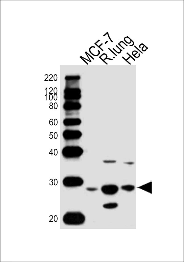 Western blot analysis of lysates from MCF-7 cell line,rat lung tissue,Hela cell line (from left to right), using GSTM4 Antibody (N-term)(Cat. #AW5125). AW5125 was diluted at 1:1000 at each lane. A goat anti-rabbit IgG H&L(HRP) at 1:10000 dilution was used as the secondary antibody.Lysates at 20ug per lane.
