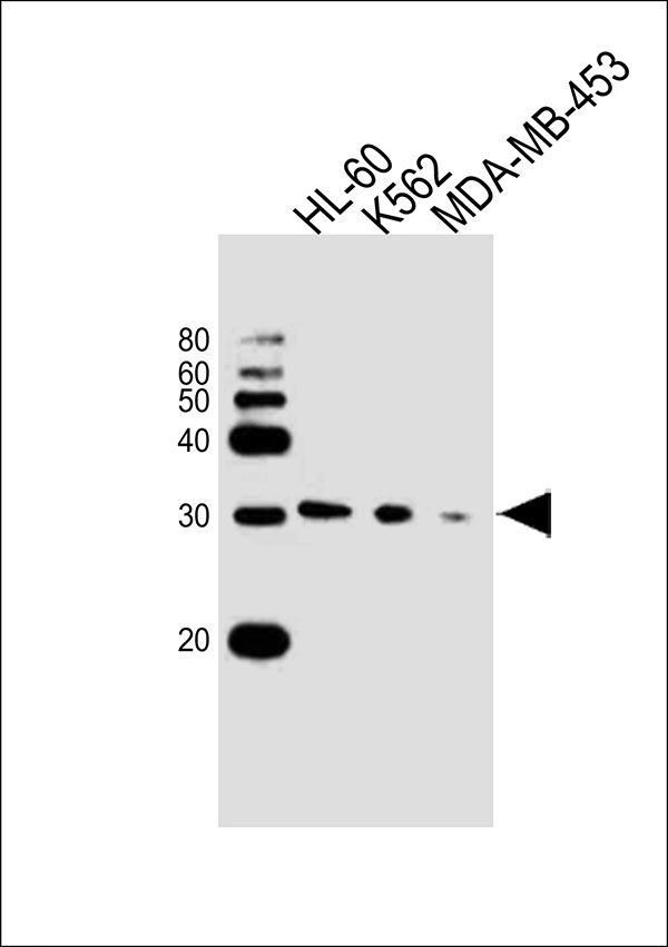 Western blot analysis of lysates from HL-60,K562,MDA-MB-453 cell line (from left to right), using SSPN Antibody (N-term)(Cat. #AW5200). AW5200 was diluted at 1:1000 at each lane. A goat anti-rabbit IgG H&L(HRP) at 1:10000 dilution was used as the secondary antibody.Lysates at 20ug per lane.