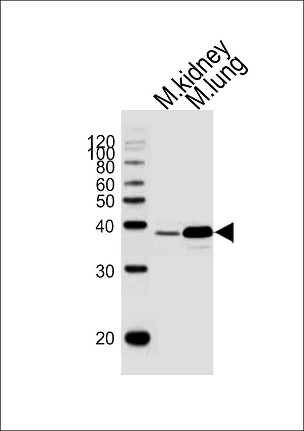 Western blot analysis of lysates from mouse kidney,mouse lung tissue lysate (from left to right), using Hoxa1 Antibody (Center)(Cat. #AW5236). AW5236 was diluted at 1:1000 at each lane. A goat anti-rabbit IgG H&L(HRP) at 1:10000 dilution was used as the secondary antibody.
