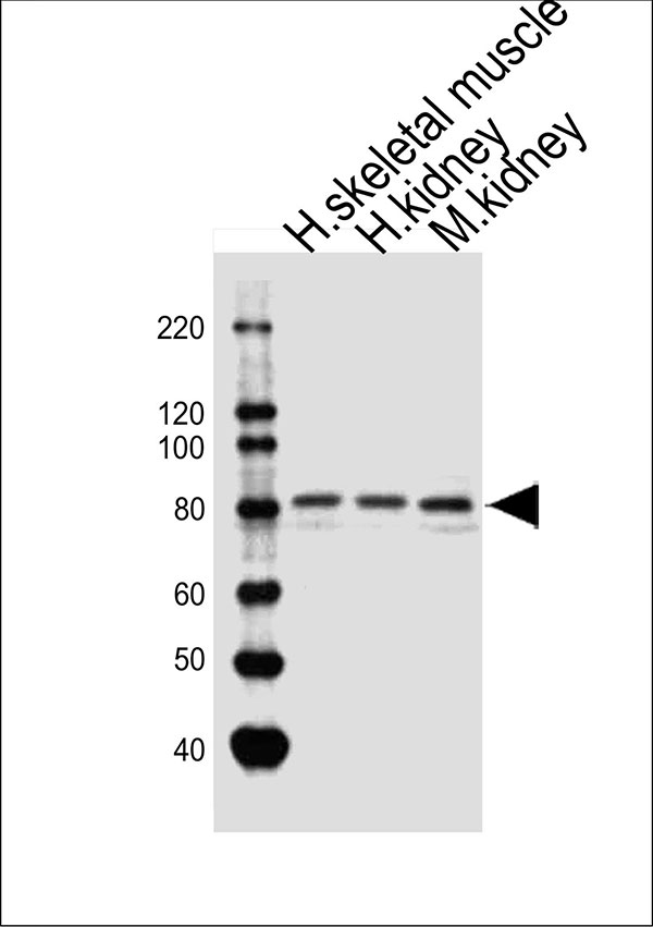 Western blot analysis of lysates from human skeletal muscle,human kidney,mouse kidney tissue (from left to right), using AMPD3 Antibody (Center)(Cat. #AW5263). AW5263 was diluted at 1:1000 at each lane. A goat anti-rabbit IgG H&L(HRP) at 1:10000 dilution was used as the secondary antibody.