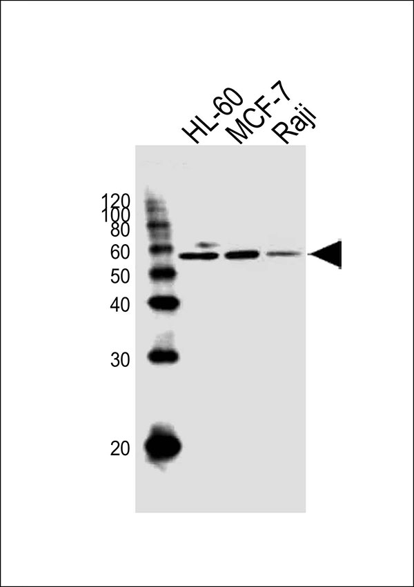 Western blot analysis of lysates from HL-60,MCF-7,Raji cell line (from left to right), using C16orf71 Antibody (Center)(Cat. #AW5285). AW5285 was diluted at 1:1000 at each lane. A goat anti-rabbit IgG H&L(HRP) at 1:10000 dilution was used as the secondary antibody.
