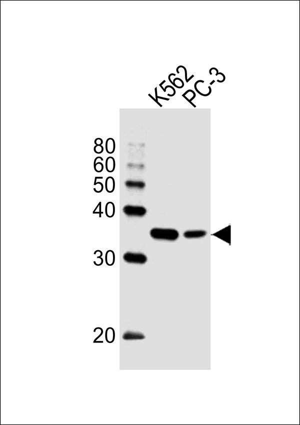 Western blot analysis of lysates from K562,PC-3 cell line (from left to right), using BBS5 Antibody (Center)(Cat. #AW5288). AW5288 was diluted at 1:1000 at each lane. A goat anti-rabbit IgG H&L(HRP) at 1:10000 dilution was used as the secondary antibody.