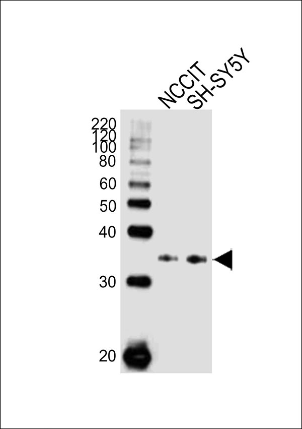 Western blot analysis of lysates from NCCIT,SH-SY5Y cell line (from left to right), using WDR82 Antibody (N-term)(Cat. #AW5310). AW5310 was diluted at 1:1000 at each lane. A goat anti-rabbit IgG H&L(HRP) at 1:10000 dilution was used as the secondary antibody.Lysates at 20ug per lane.