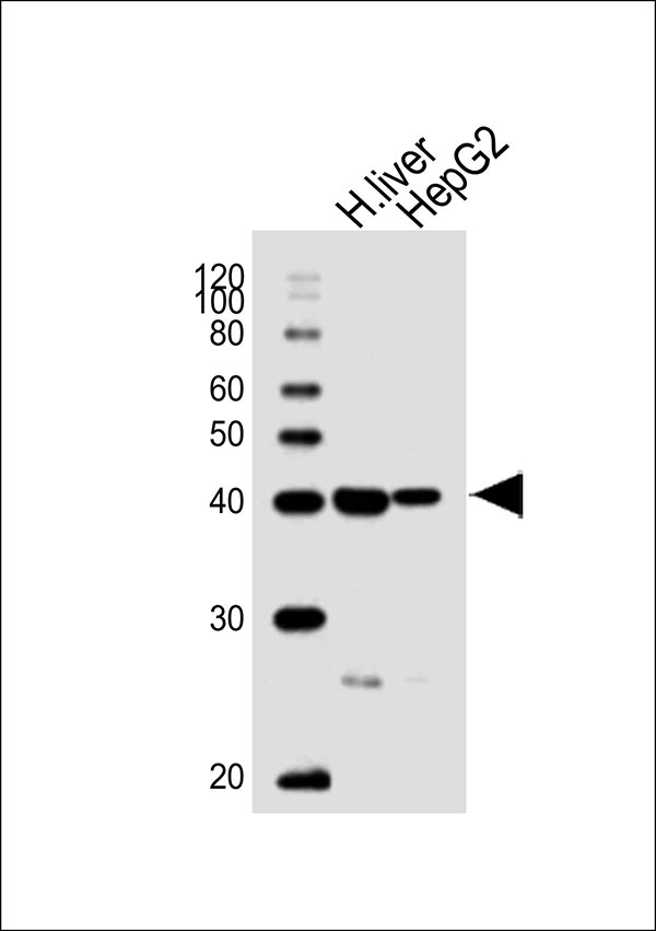 Western blot analysis of lysates from human liver tissue lysate,HepG2 cell line (from left to right), using ACADSB Antibody (Center)(Cat. #AW5336). AW5336 was diluted at 1:1000 at each lane. A goat anti-rabbit IgG H&L(HRP) at 1:10000 dilution was used as the secondary antibody.Lysates at 20ug per lane.