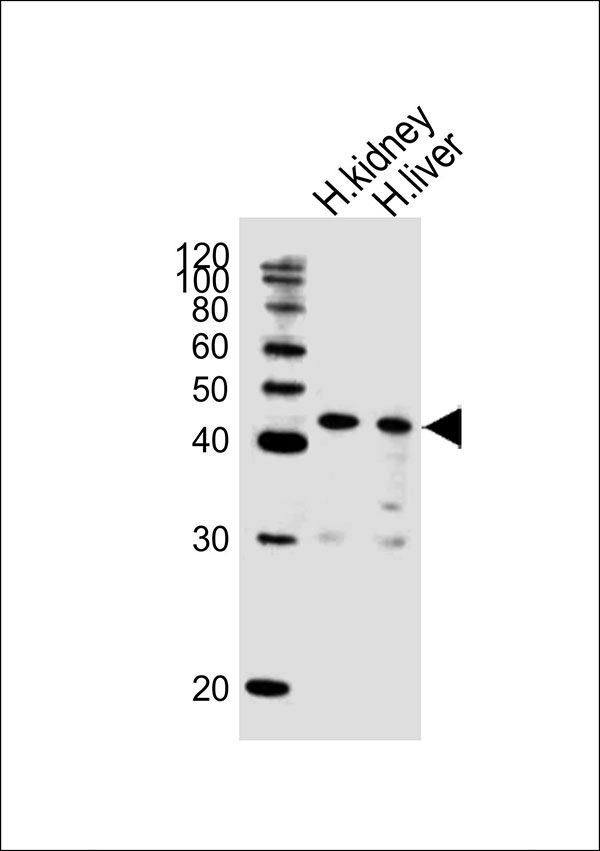 All lanes : Anti-POU5F1B Antibody (C-term)(AW5361) at 1/1000 dilution Lane 1: human kidney lysates Lane 2: human liver lysates Lysates/proteins at 20 µg per lane. Secondary Goat Anti-Rabbit IgG, (H+L),Peroxidase conjugated at 1/10000 dilution Predicted band size : 44 kDa Blocking/Dilution buffer: 5% NFDM/TBST.