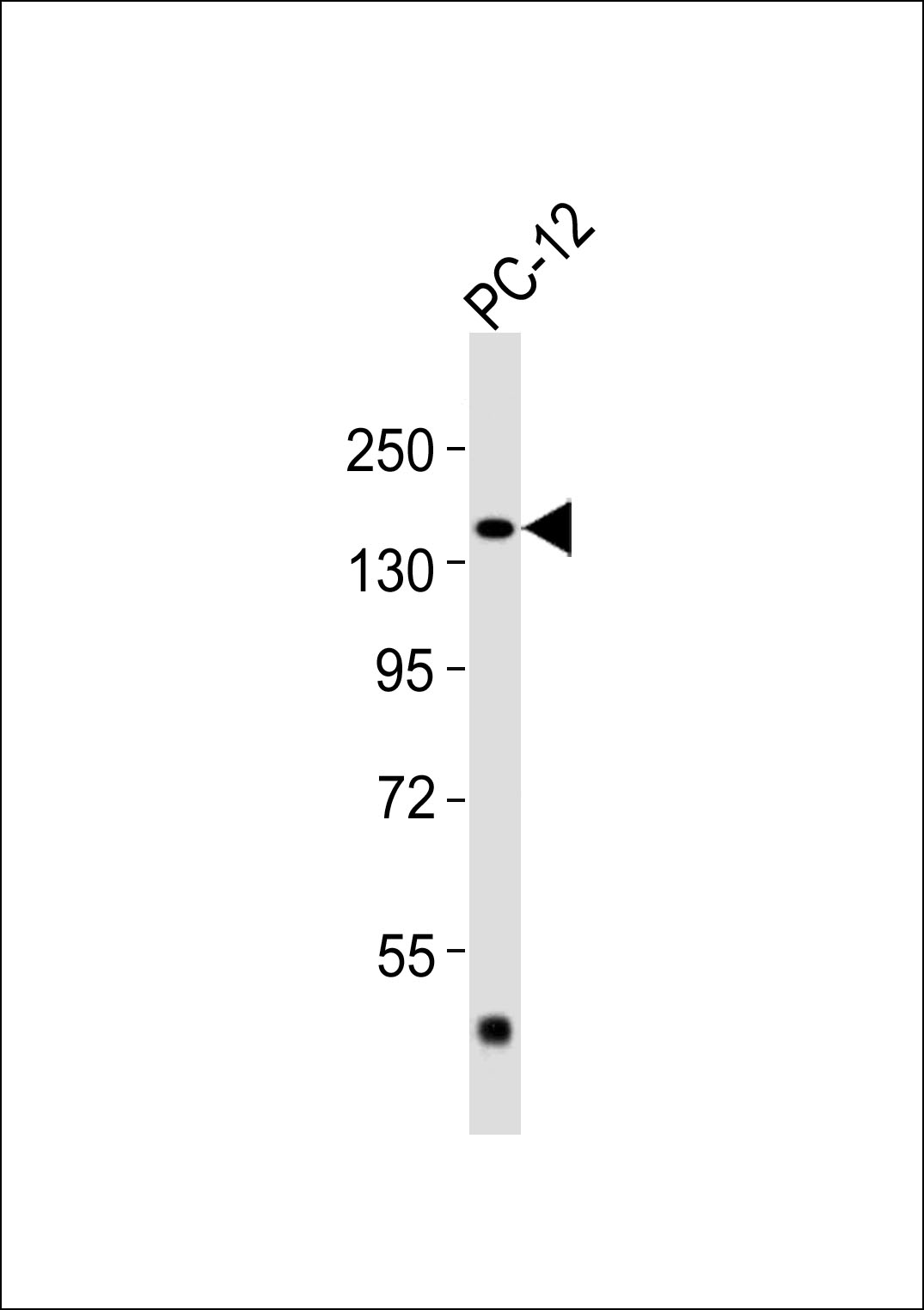 Anti-Adenylate Cyclase 5/6 Antibodyat 1:1000 dilution + PC-12 whole cell lysates Lysates/proteins at 20 µg per lane. Secondary Goat Anti-Rabbit IgG, (H+L),Peroxidase conjugated at 1/10000 dilution Predicted band size : 139 kDa Blocking/Dilution buffer: 5% NFDM/TBST.