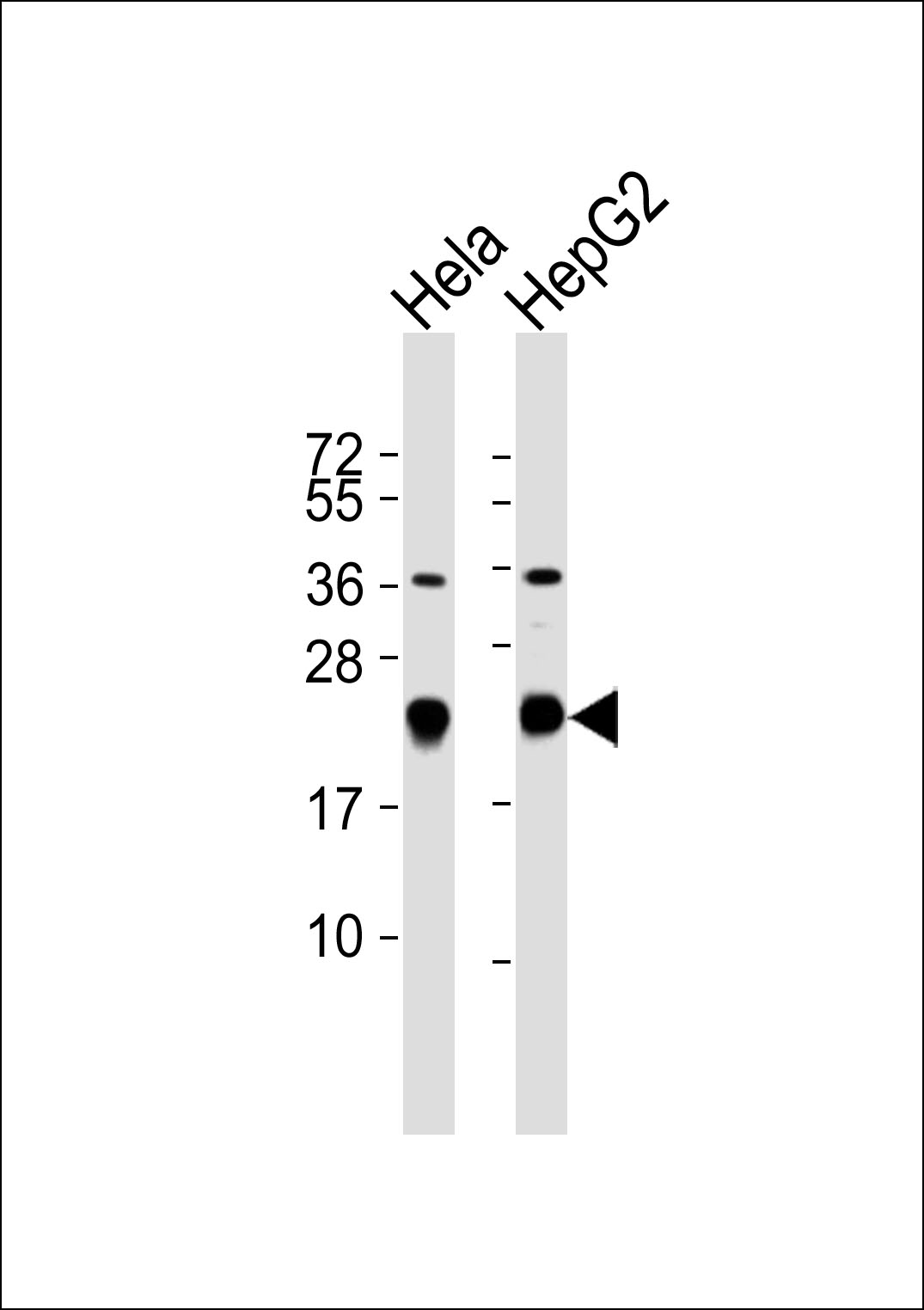 All lanes : Anti-RPL17 Antibody at 1:1000 dilution Lane 1: Hela whole cell lysates Lane 2: HepG2 whole cell lysates Lysates/proteins at 20 µg per lane. Secondary Goat Anti-Rabbit IgG, (H+L),Peroxidase conjugated at 1/10000 dilution Predicted band size : 21 kDa Blocking/Dilution buffer: 5% NFDM/TBST.